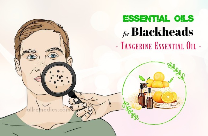 essential oils for blackheads