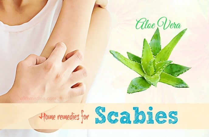 home remedies for scabies