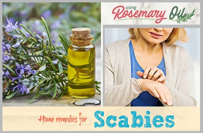 home remedies for scabies