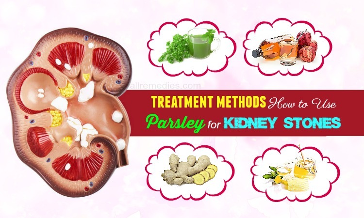 parsley for kidney stones