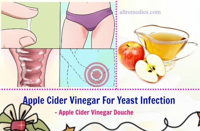 apple cider vinegar for yeast infection treatment