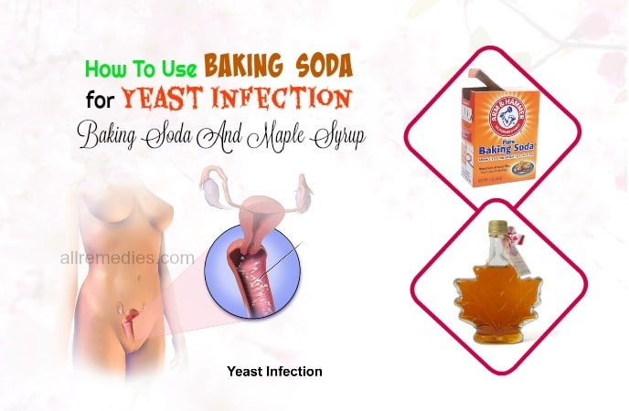 baking soda for yeast infection