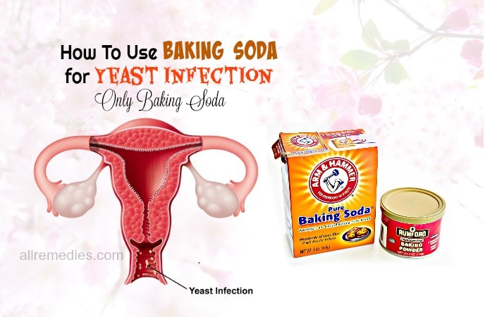 baking soda for yeast infection