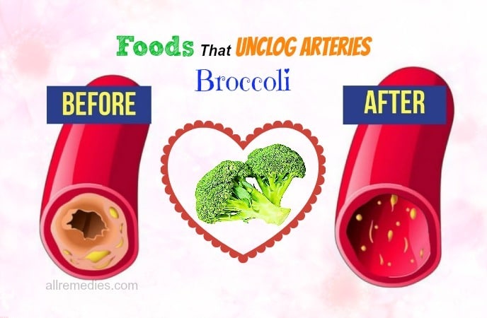 foods that unclog arteries fast -broccoli