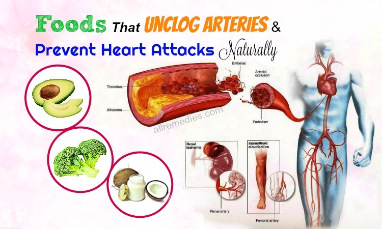 foods that unclog arteries