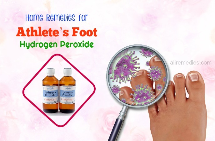 home remedies for athlete’s foot with blisters-hydrogen peroxide