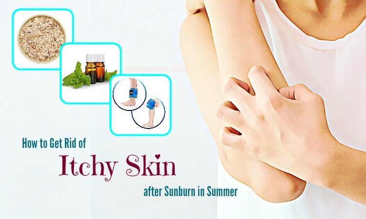 how to get rid of itchy skin in summer