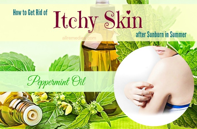 how to get rid of itchy skin after sunburn