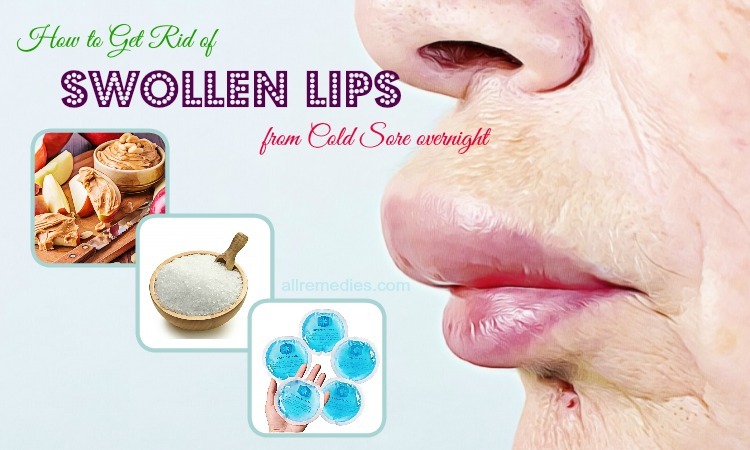how to get rid of swollen lip