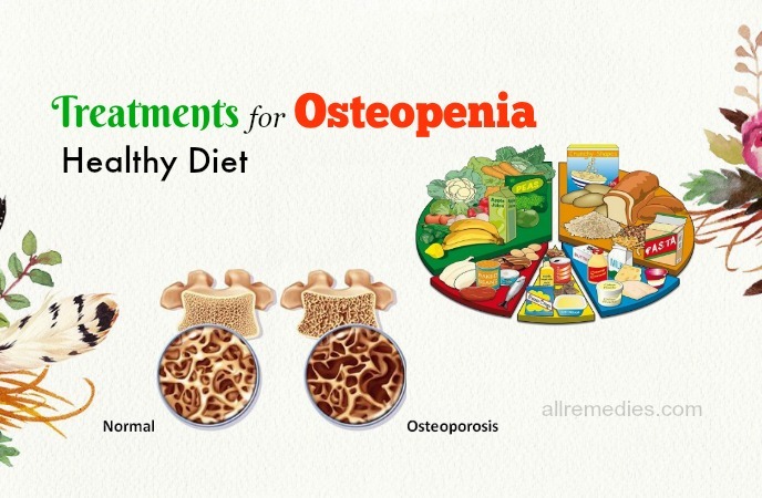 treatments for osteopenia