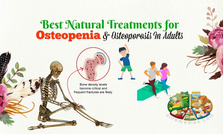 treatments for osteopenia