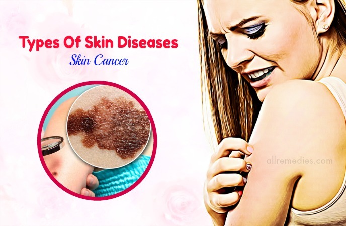 common types of skin diseases