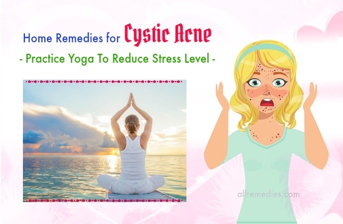 home remedies for cystic acne