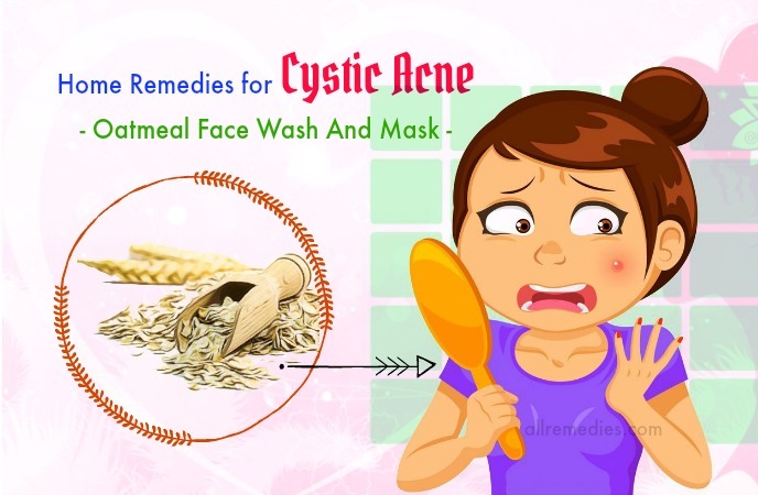 home remedies for cystic acne scars