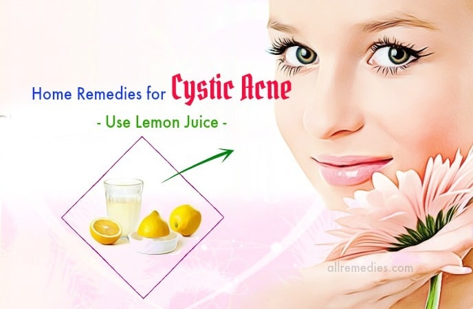 home remedies for cystic acne swelling