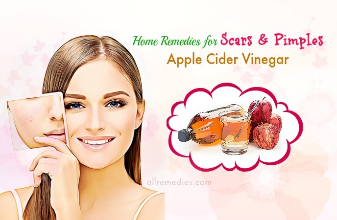 home remedies for scars overnight