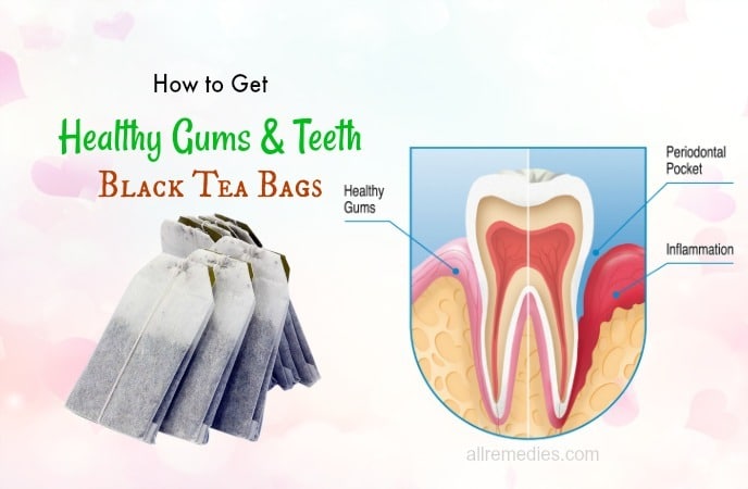 how to get healthy gums fast