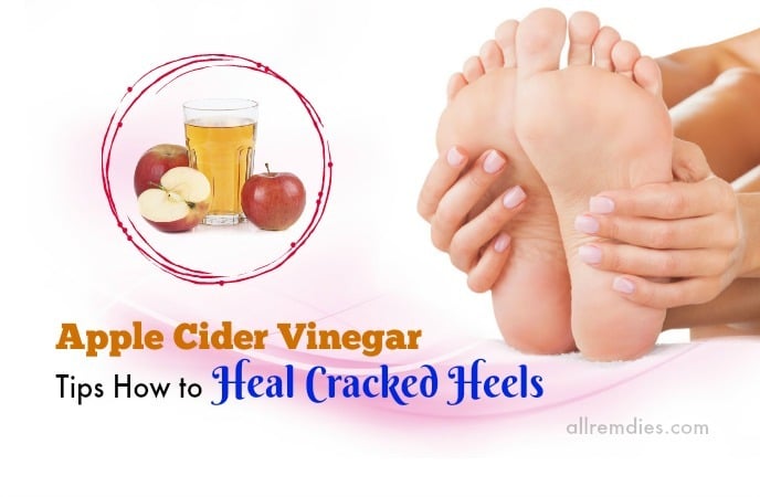 how to heal cracked heels at home