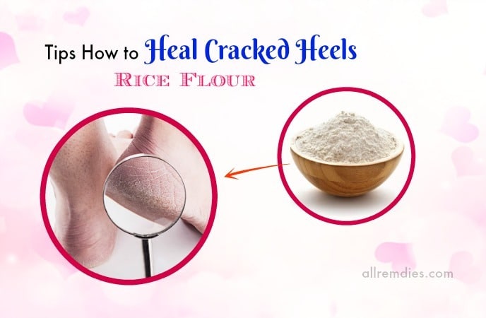 how to heal cracked heels in winter