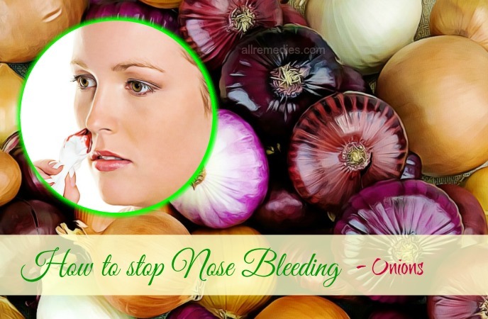 how to stop nose bleeding home remedies