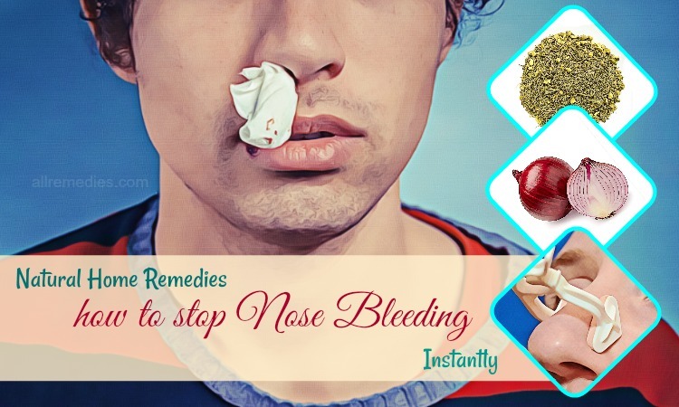 how to stop nose bleeding