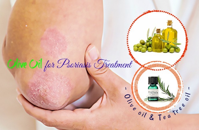 olive oil for psoriasis treatment