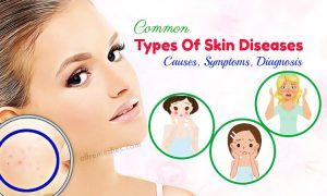 Top 7 Common Types Of Skin Diseases: Causes, Symptoms, Diagnosis