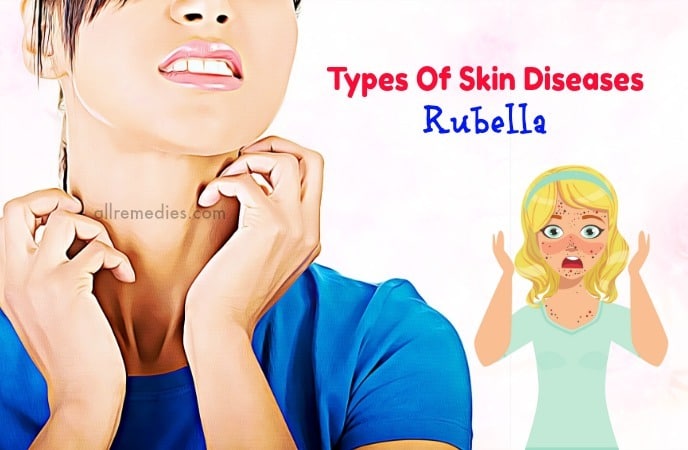 types of skin diseases and symptoms