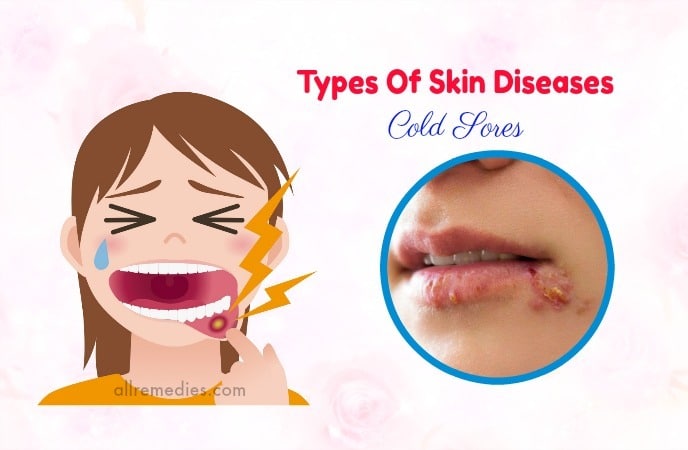 types of skin diseases causes