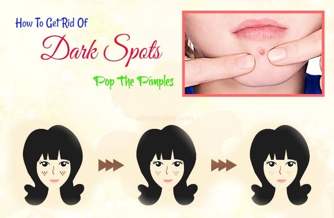 how to get rid of dark spots on face