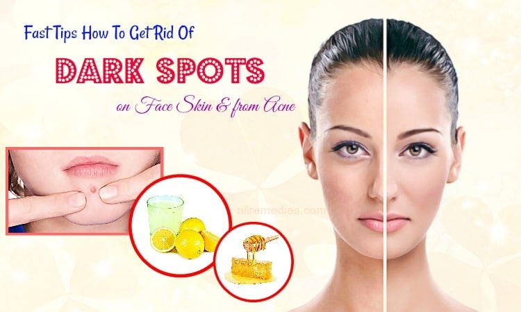 How To Get Rid Of Dark Spots On Skin