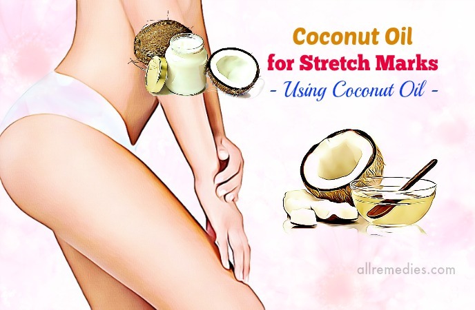 coconut oil for stretch marks on thighs