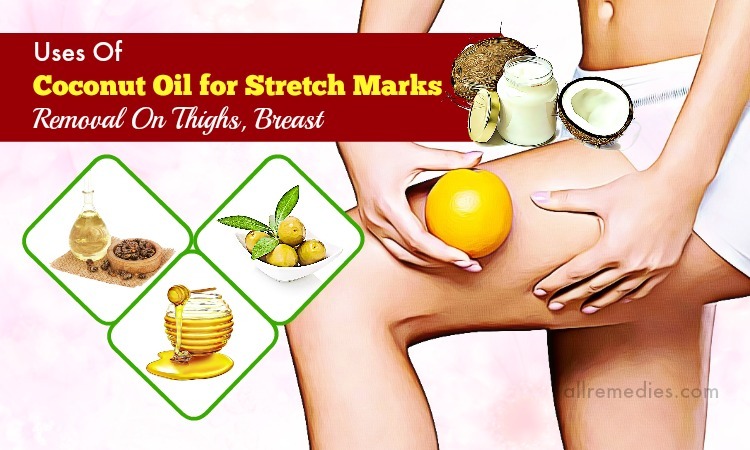 coconut oil for stretch marks