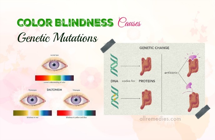 color blindness causes and symptoms