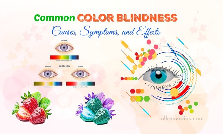 color blindness causes