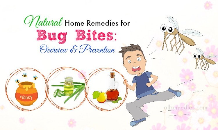 home remedies for bug bites