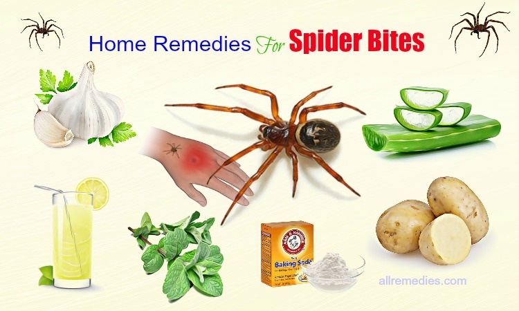 home remedies for spider bites