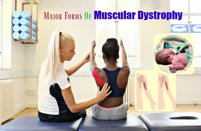 muscular dystrophy treatment