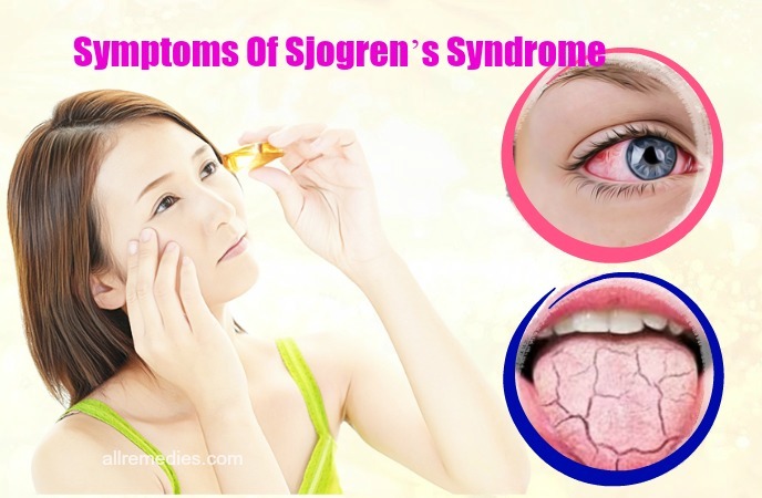 sjogren syndrome causes