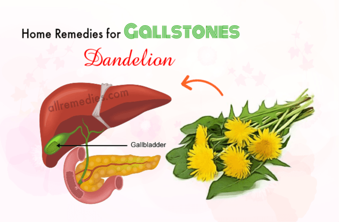 home remedies for gallstones pain