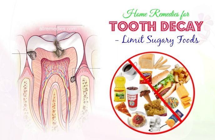 home remedies for tooth decay pain