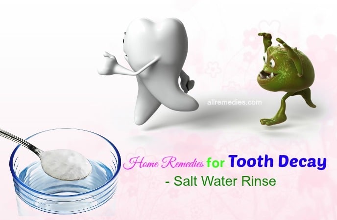 home remedies for tooth decay