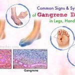 symptoms of gangrene