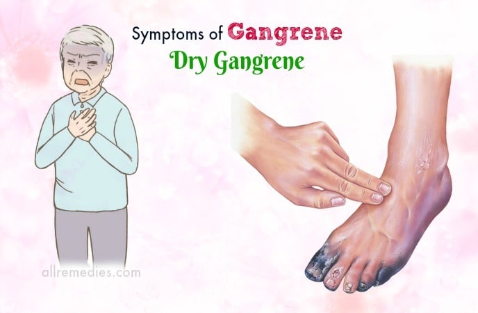 symptoms of gangrene disease